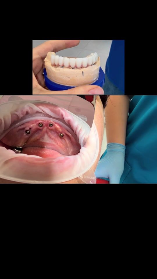 TikTok video thumbnail by dr.rora