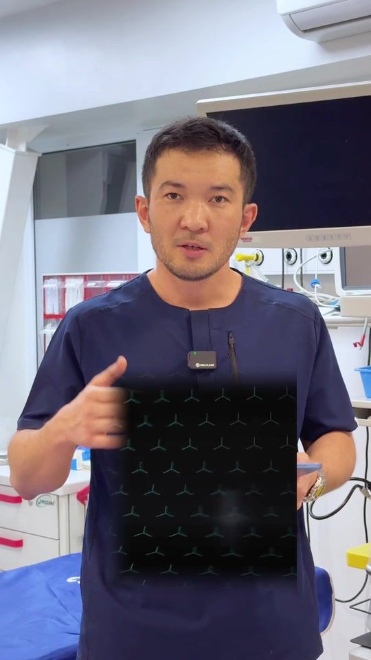 TikTok video thumbnail by almaty_endoscopy