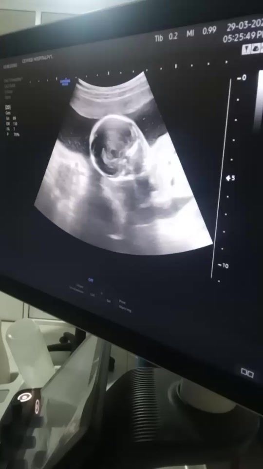 TikTok video thumbnail by call___me___thanu__02