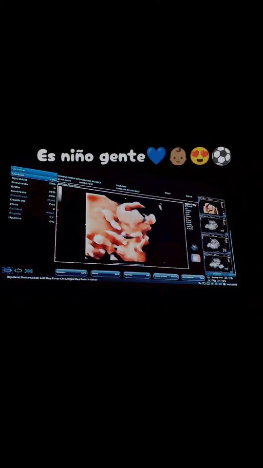 TikTok video thumbnail by anuel_aa_2blea