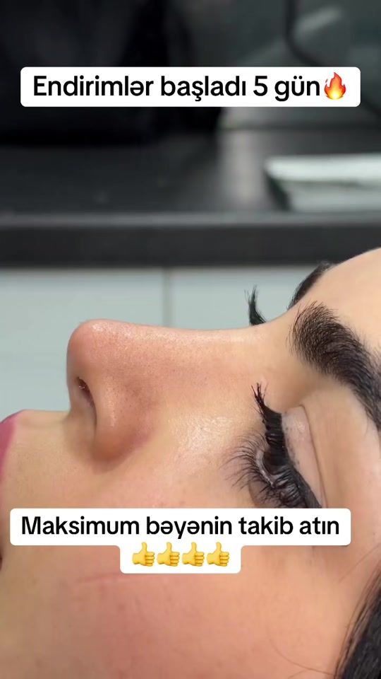 TikTok video thumbnail by dr.rino.med