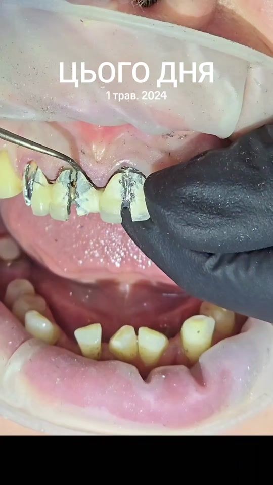 TikTok video thumbnail by dr.vadim.meloian