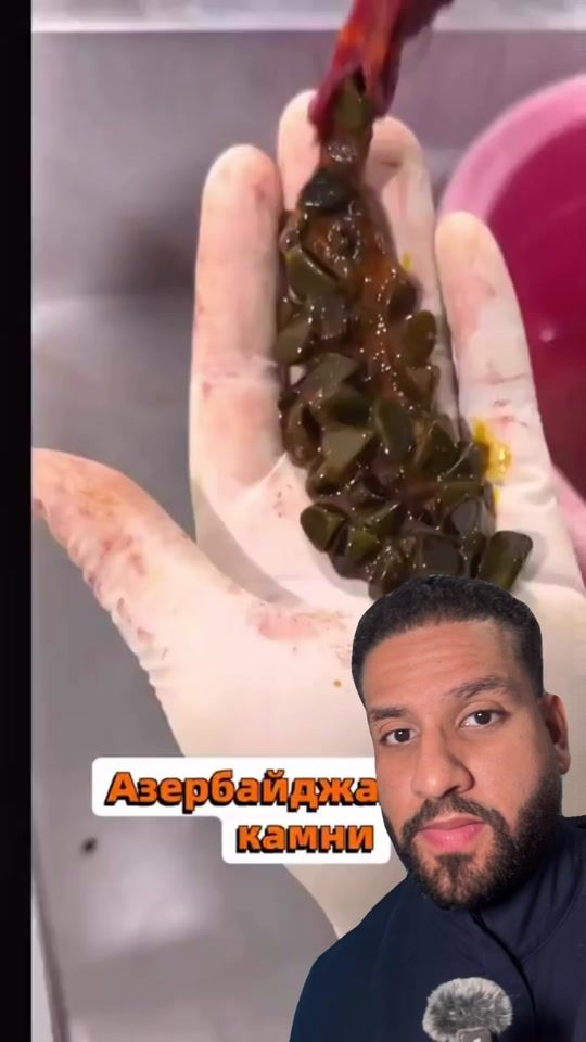 TikTok video thumbnail by doctor.humber