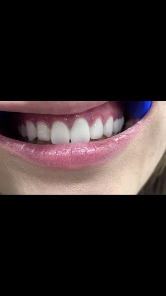 TikTok video thumbnail by stomatoloqelxan