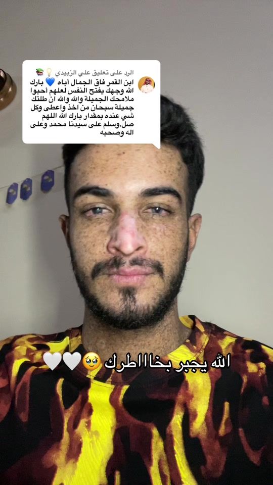 TikTok video thumbnail by t67r1