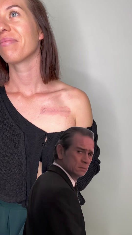 TikTok video thumbnail by swlasertattooremoval