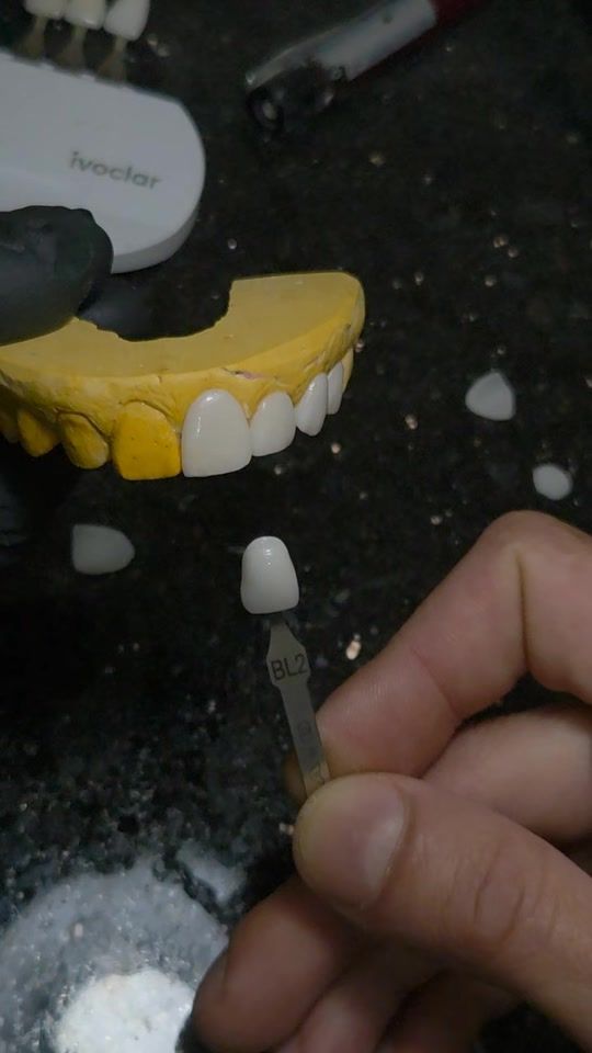 TikTok video thumbnail by dental.stu.dio