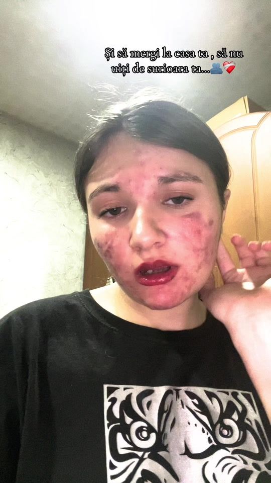TikTok video thumbnail by ana._.maria._.17_