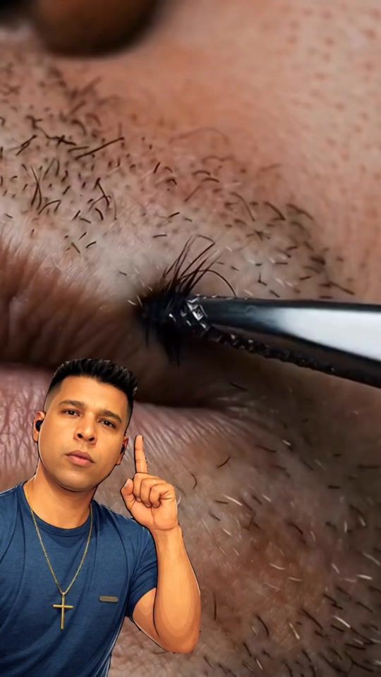 TikTok video thumbnail by rovshen.cosmetics