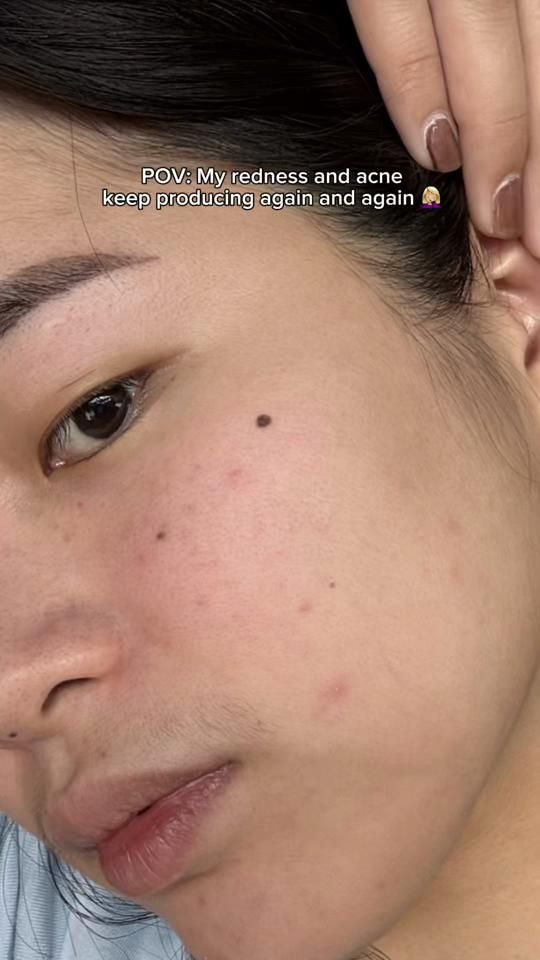 TikTok video thumbnail by jovi.enriquez