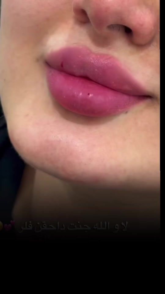TikTok video thumbnail by karada.clinic