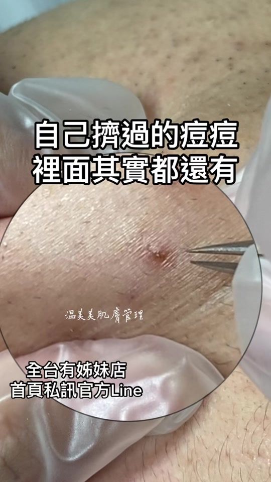 TikTok video thumbnail by wenmeimei_skin_care