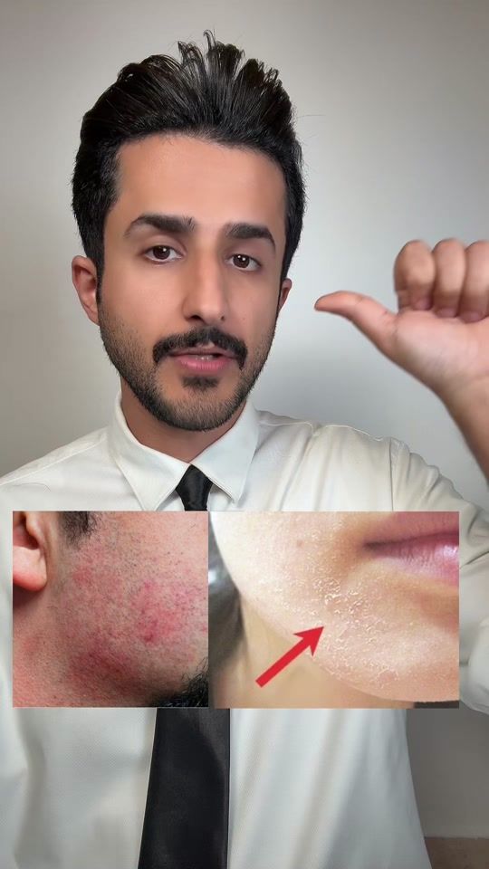 TikTok video thumbnail by yasser_tamimi
