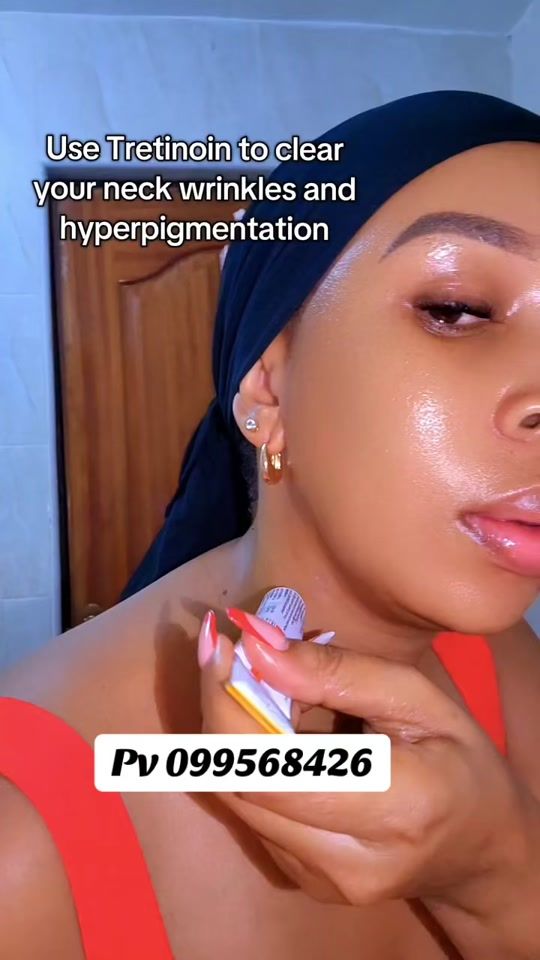 TikTok video thumbnail by mustaphakamara792