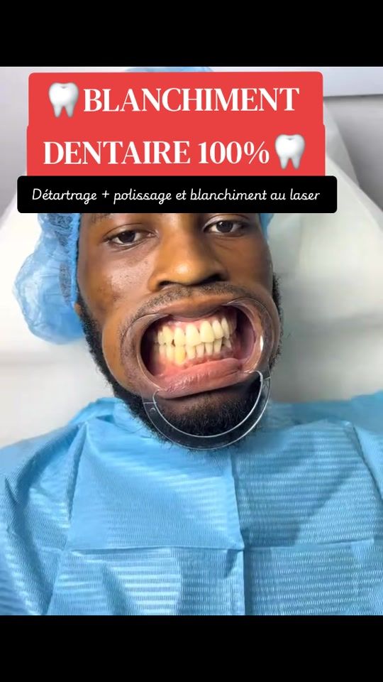 TikTok video thumbnail by a.u.t.o.ri.t.e.den