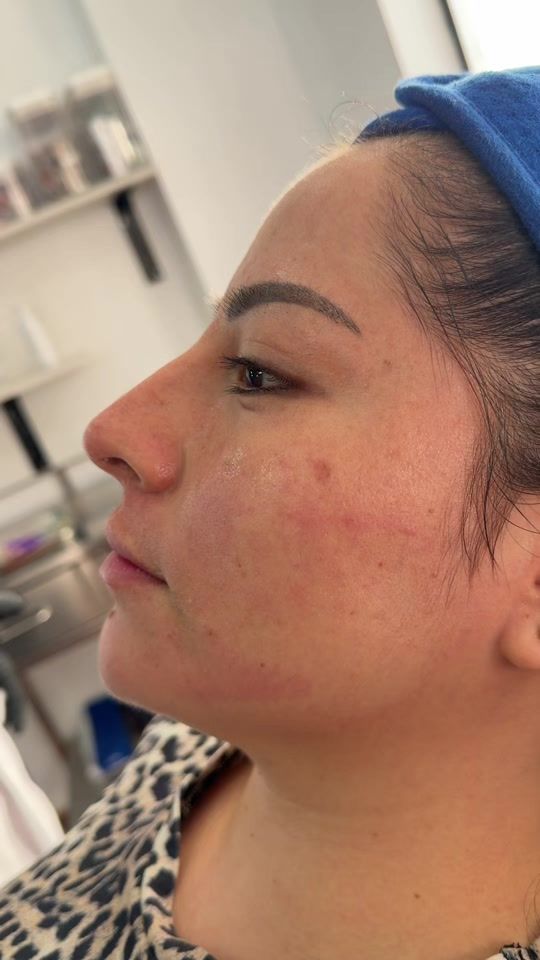 TikTok video thumbnail by drmarianojaramillo