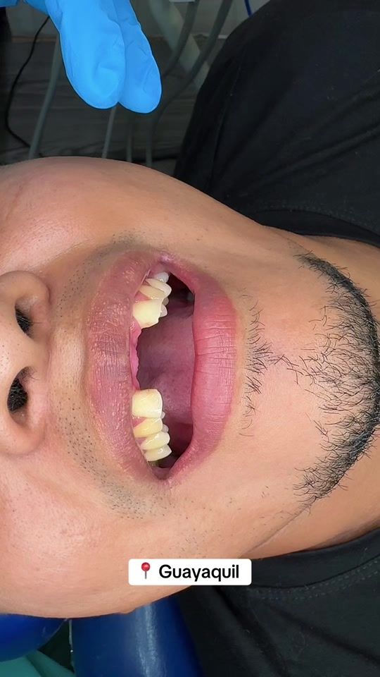 TikTok video thumbnail by queendental2019