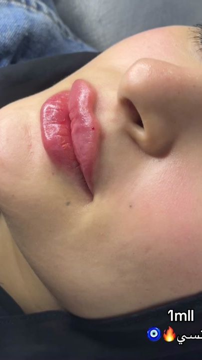 TikTok video thumbnail by beauty_center_secret2