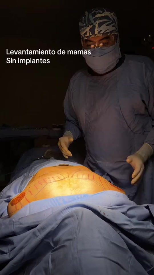TikTok video thumbnail by cirugiaplastica.anibal