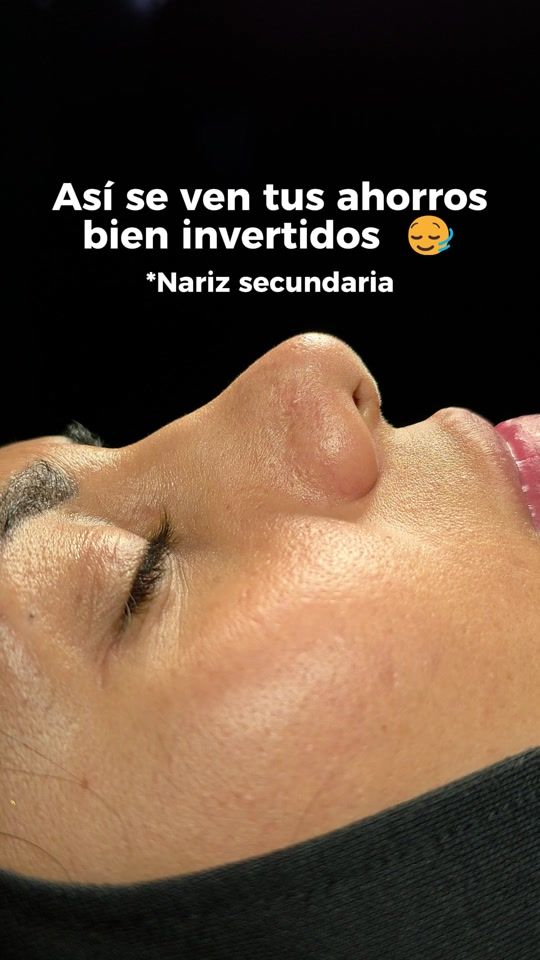 TikTok video thumbnail by drgermanbernal