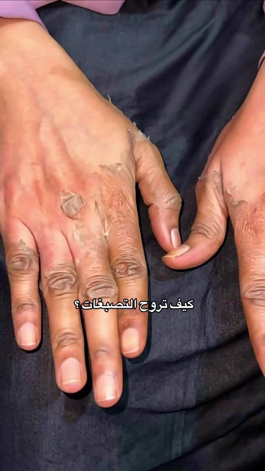 TikTok video thumbnail by 7poo3