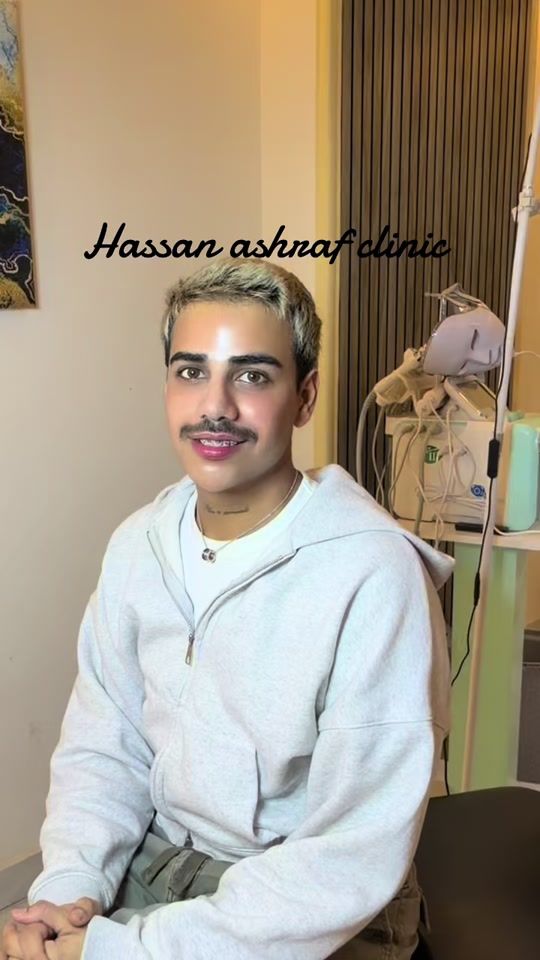 TikTok video thumbnail by hassan....ashraf