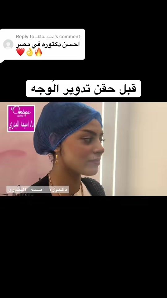 TikTok video thumbnail by dr.amina.albadry
