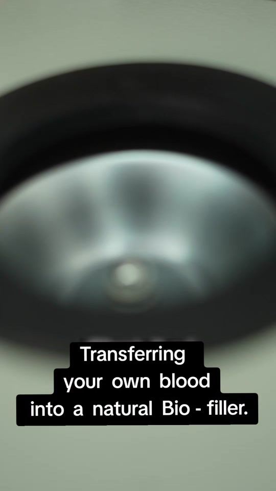 TikTok video thumbnail by pierreach