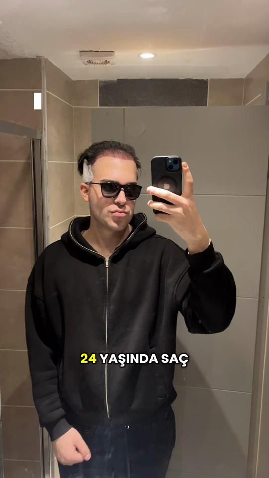 TikTok video thumbnail by bilalbcc