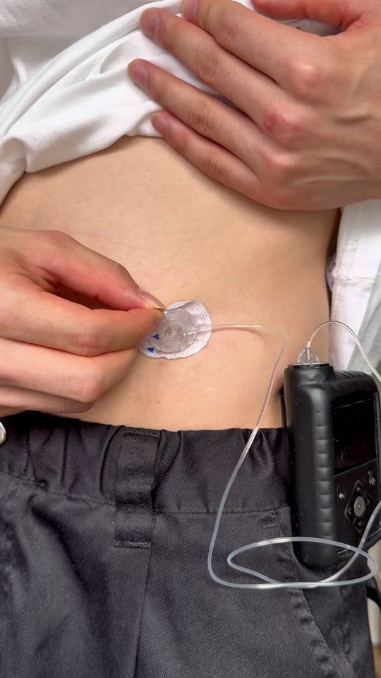 TikTok video thumbnail by kakediabetes