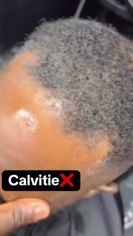 TikTok video thumbnail by iconic_3230
