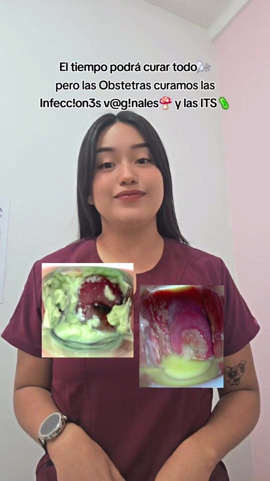 TikTok video thumbnail by obstetrascontigo