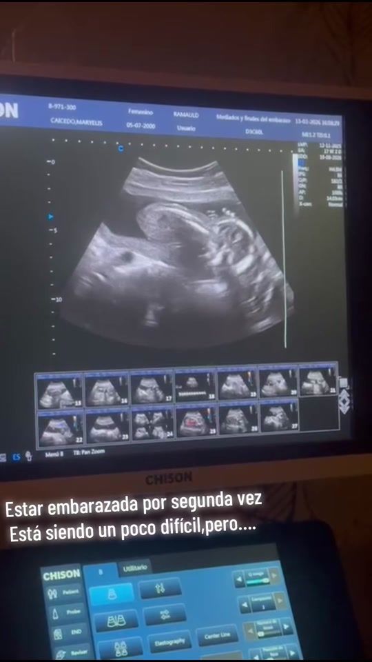 TikTok video thumbnail by diegoandre.05