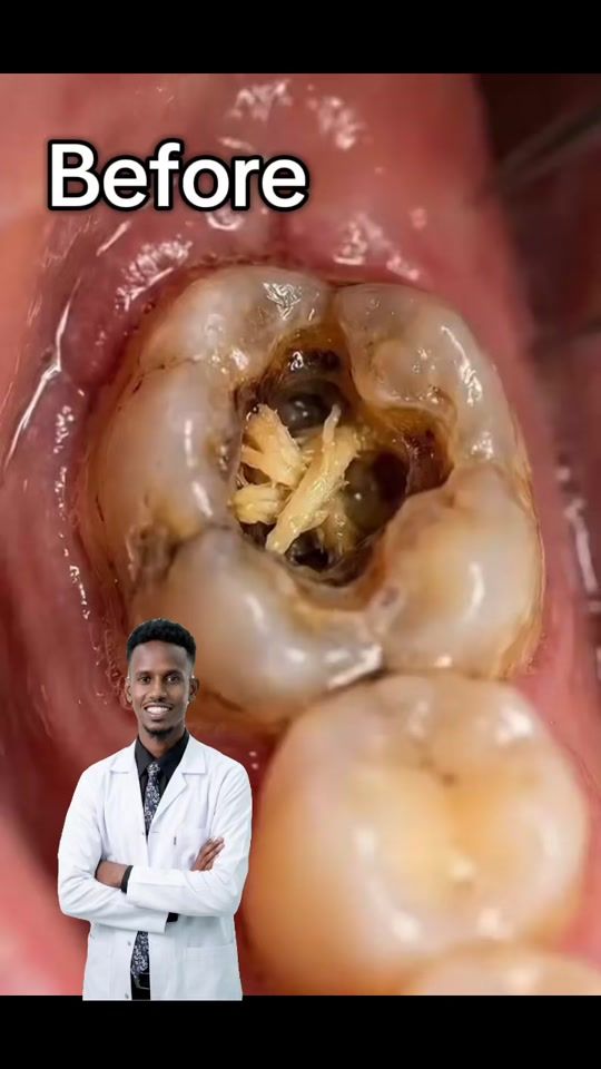 TikTok video thumbnail by dr.bileabdullahiahmed