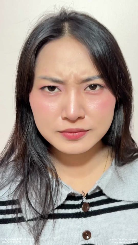 TikTok video thumbnail by somchaiclinic_