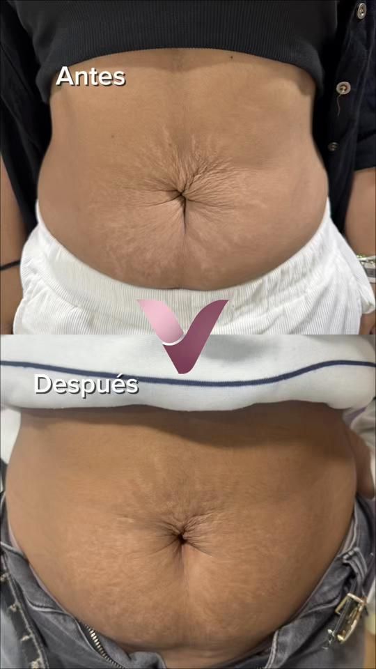 TikTok video thumbnail by vittadermi