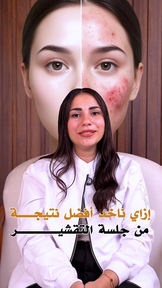 TikTok video thumbnail by beirutclinics