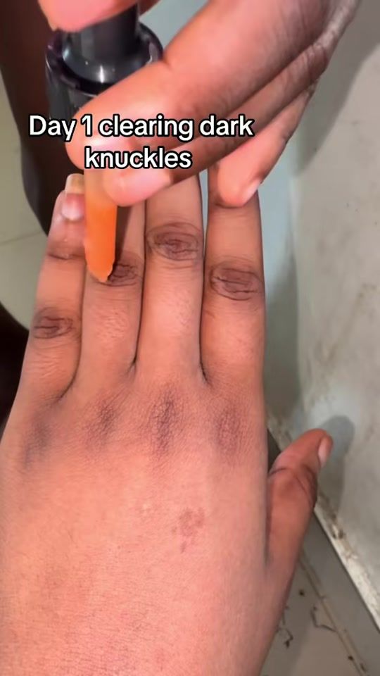 TikTok video thumbnail by driaglowchant_
