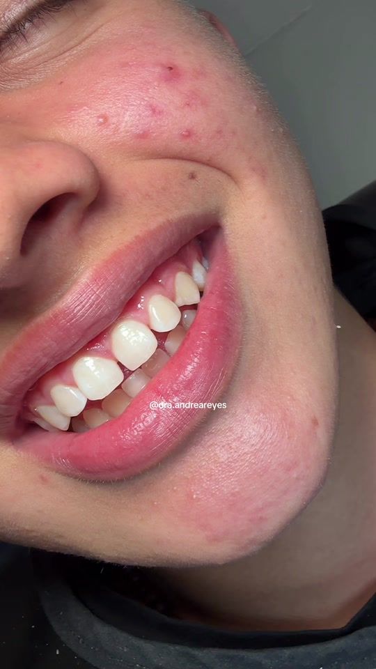 TikTok video thumbnail by dra.andreareyes