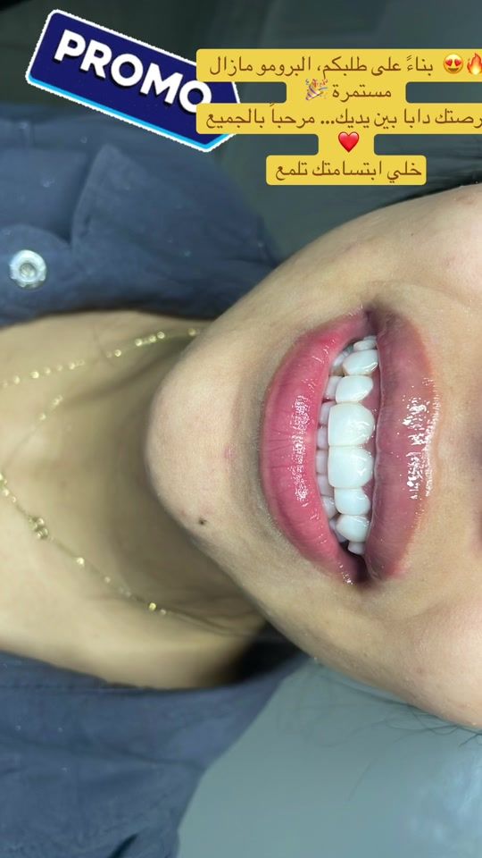TikTok video thumbnail by hasnaa.smile