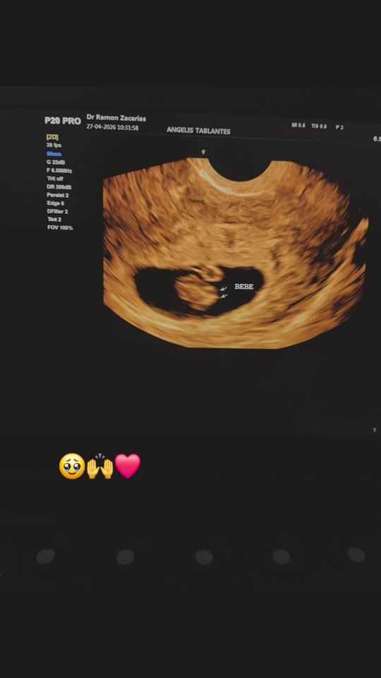 TikTok video thumbnail by ronni.carreo