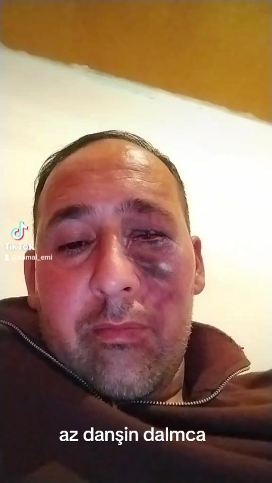 TikTok video thumbnail by camal_emi