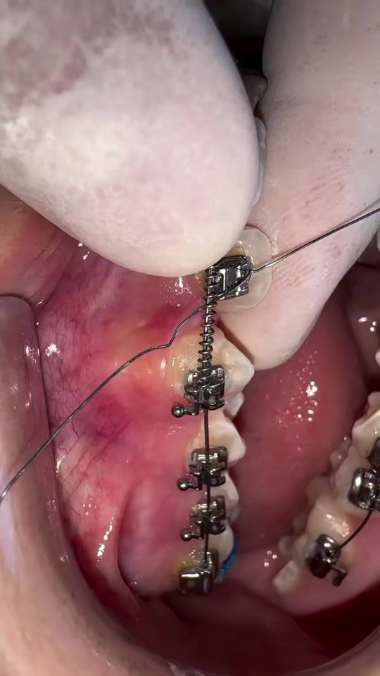 TikTok video thumbnail by drmohanisaid