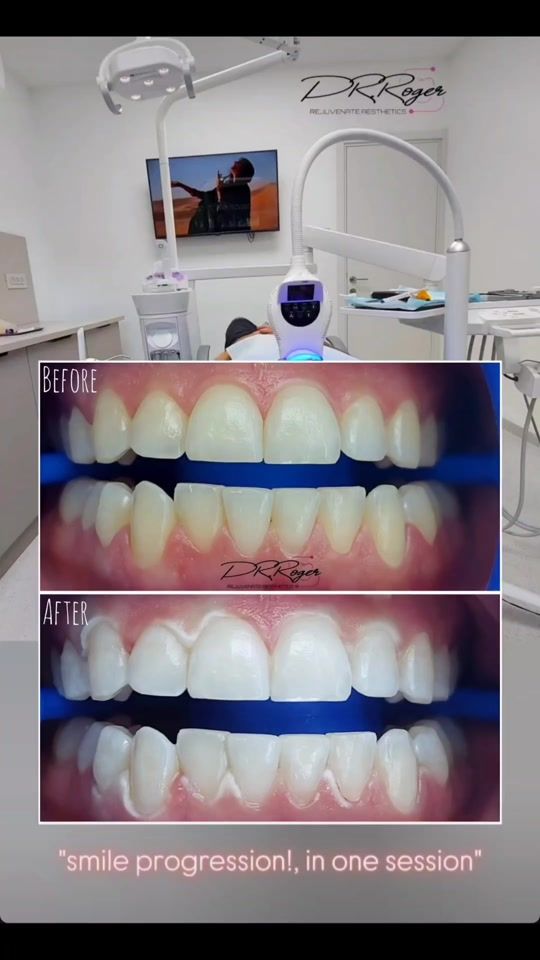 TikTok video thumbnail by dr.roger.dentist