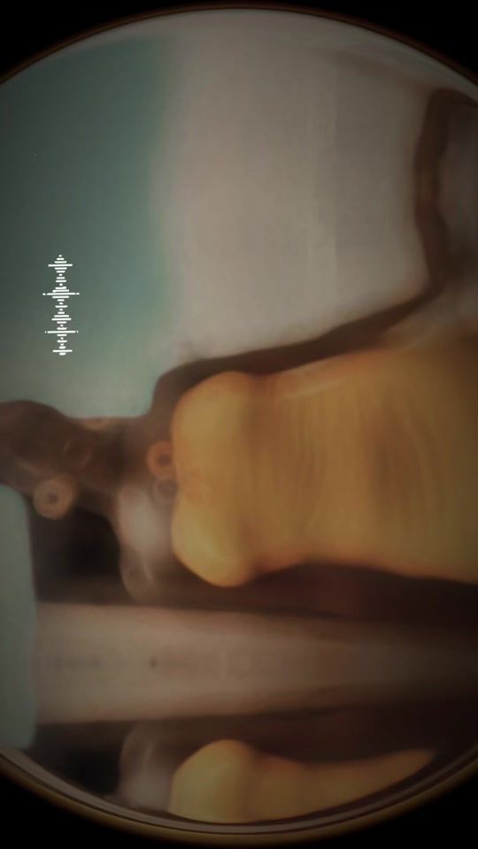 TikTok video thumbnail by rema.chaima