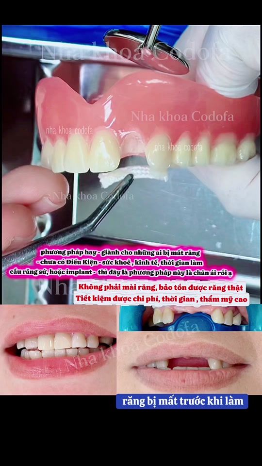 TikTok video thumbnail by nhakhoa_codofa