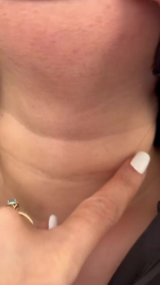 TikTok video thumbnail by doktor6878