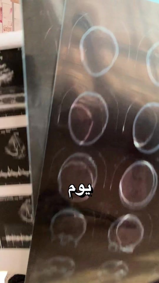 TikTok video thumbnail by omniaawaddd