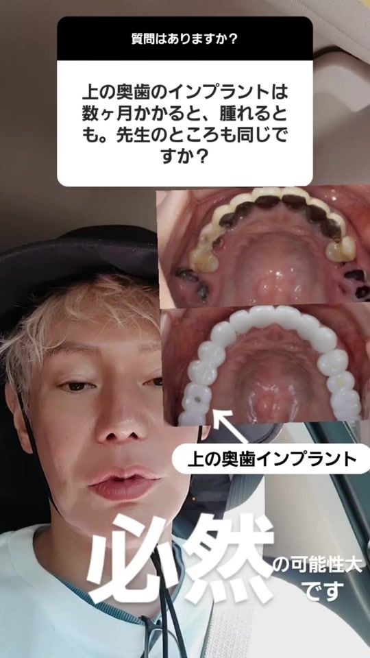 TikTok video thumbnail by diamond_imai_