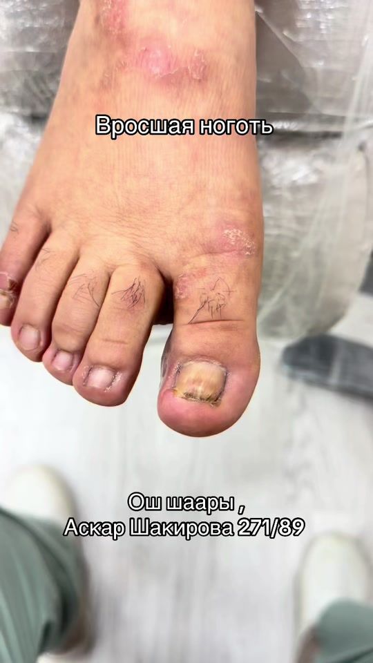 TikTok video thumbnail by podologiya_osh